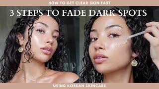 HOW TO FADE DARK SPOTS FAST  3 steps  skincare facts & tips for acne