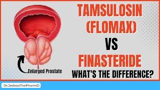 Tamsulosin Flomax Vs Finasteride for Benign Prostatic Hyperplasia  Side Effects You MUST Know