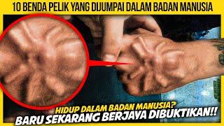 10 BENDA PELIK YANG DIJUMPAI DALAM BADAN MANUSIA