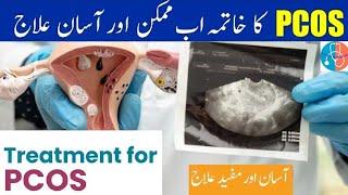 What is PCOS Treatment  PCOS Ka ilaj  Polycystic Ovaries  Urdu Hindi  Health & Medical Care