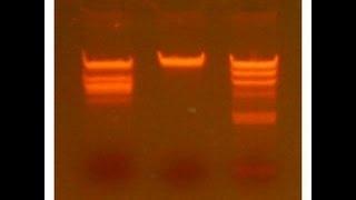 Restriction Digestion - Amrita University