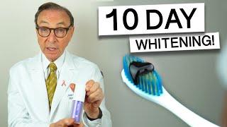 Hismile Purple Toothpaste for 10 Days - Dentist Review #teethwhitening