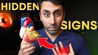 Doctor Explains Heart Attack Symptoms 7 Warning Signs You Should NEVER Ignore 🫀️