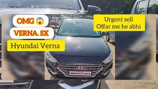  OMG. VERNA SX #verna #hyundai #hyundaiverna koi bhi gadi kharide   No.9340613963 all car available