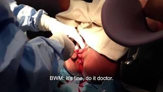 Birth video epidural and episiotomy