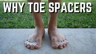 Why Toes Spacers?  Guide on Different Toe Spacers
