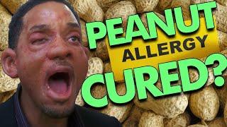 How I cured my Peanut Allergy in 6 weeks