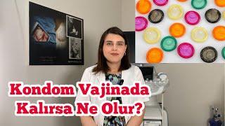 🟠 Kondom Vajinada Kalırsa Ne Olur? - Vajinada Prezervatif Kalması