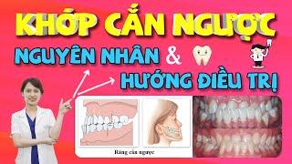 Khớp Cắn Ngược - Nguyên Nhân & Cách Điều Trị  Nam Bùi Vinalign  Niềng Răng