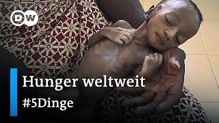 Steigende Hungersnot Diese Länder sind am schwersten betroffen  5 Dinge