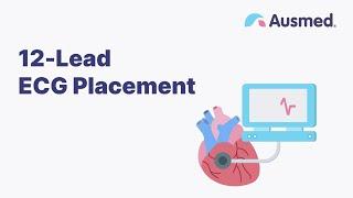 12-Lead ECG Placement  Ausmed Explains...