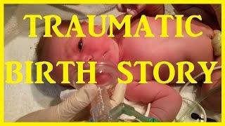 Hypnobirthing-GONE WRONG MY SCARY PREECLAMPSIA BIRTH STORY WARNING GRAPHIC IVF ICSI  First Baby.
