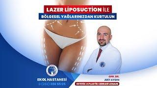 İzmir Ekol Hastanesi - Lazer Liposuction ile Bölgesel Yağlarınızdan Kurtulun - Opr. Dr. Arif Aydın