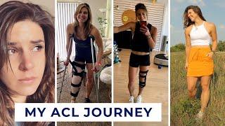 How I came back stronger after ACL surgery  Volleyball player shares emotional ACL story