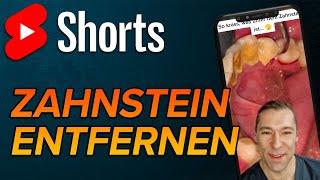 Zahnstein 2.0 #shorts