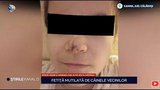 Stirile Kanal D - Fetita mutilata de cainele vecinilor  Editie de seara