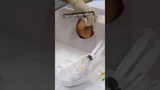 How to pass foley catheter  Male Foley Catheter  Female foley catheter