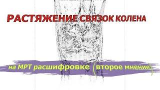 РАСТЯЖЕНИЕ передней крестообразной связки и АРТРОЗ 1 степени на РАСШИФРОВКЕ МРТ коленного сустава