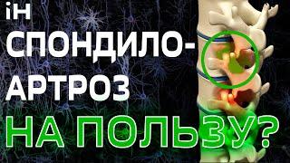 На пользу ли спондилоартроз?  iНЕВРОЛОГ