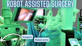 How robot assisted surgery works as explained by a surgeon