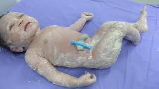 Medical Education Video Neonatology Vernix Caseosa