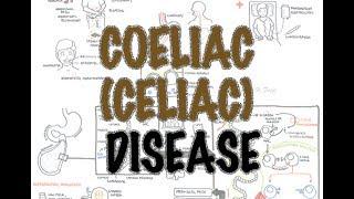Coeliac Celiac Disease - Overview signs and symptoms pathophysiology diagnosis treatment