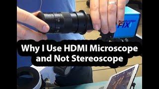 Why I prefer HDMI Microscope and not Binocular Stereoscope. What is a Barlow lens and comparison