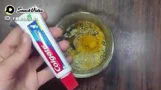 Outstanding Homemade Remedy for Teeths Problems دانتوں کے مسائل کا شاندار گھریلو علاج #short