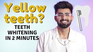Teeth Whitening at Home  दांत सफ़ेद करने का सबसे तेज़ तरीक़ा  Mridul Madhok