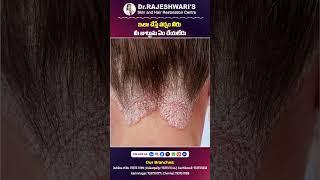 Rainy Season Hair Care Tips in Telugu  Dr Rajeshwaris Health Care  #shorts #ytshorts