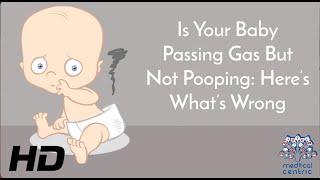 Is Your Baby Passing Gas But Not PoopingHeres Whats Wrong