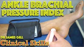 How To Measure ABPI - Ankle Brachial Pressure Index Clinical Examination - Vascular OSCE - Dr Gill