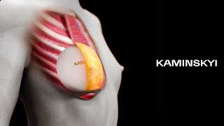 Round implants above the muscle  KAMINSKYI