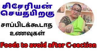 food to avoid after C-sectionசிசேரியன் செய்த பிறகு சாப்பிடக்கூடாத உணவுகள்