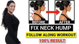 How to Fix a Neck Hump at Home FAST Fix Neck Hump FAST With These Home Exercises Follow Along