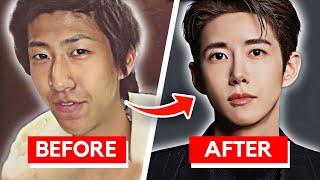 Korean Actors With The Most Crazy Plastic Surgeries Part 3