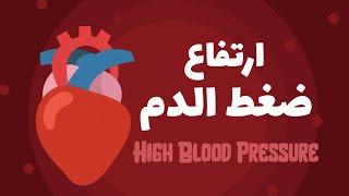ارتفاع ضغط الدم High Blood Pressure