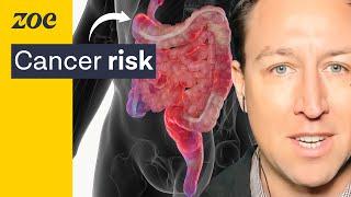 Inflammation drives the leading cause of death Heres how to reverse it  No.1 Gut Scientist