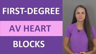 First-Degree AV Heart Block Nursing NCLEX ACLS ECGEKG Prolonged PR Interval