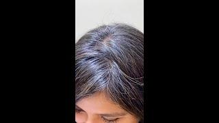 Reversing grey hair into black again 6 months journey with Satthwa Kalika hair oil #shorts