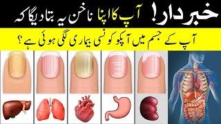 Your nail will tell you what disease you have  ناخن بتائے گا آپکو کونسی بیماری لگی ہوئی ہے