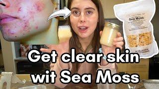 How to make Sea Moss for Acne Free Skin and Collagen Production