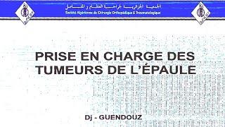 Prise en charge des tumeurs de lépaule