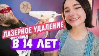 Удалили тату В 14 ЛЕТ  ЛАЗЕРНОЕ УДАЛЕНИЕ  избавиться от тату