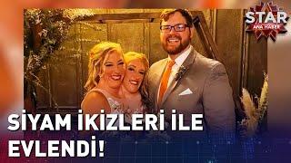 Siyam İkizleri İle Evlendi  Star Ana Haber