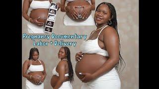 Pregnancy Documentary 31+ wks Labor & Delivery + Emergency C-Section