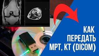 Как передать МРТ КТ рентген исследование DICOM? Онлайн консультация