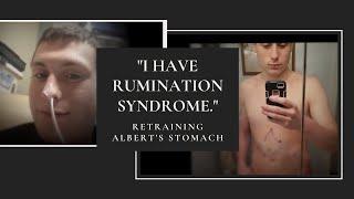 I Have Rumination Syndrome  Retraining Alberts Stomach