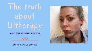 The truth about Ultherapy  Alice Hart-Davis