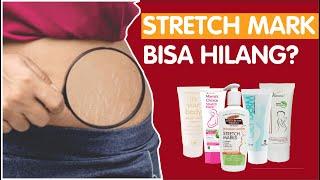 CARA MENGHILANGKAN STRETCH MARK - REVIEW 5 KRIM STRETCH MARK